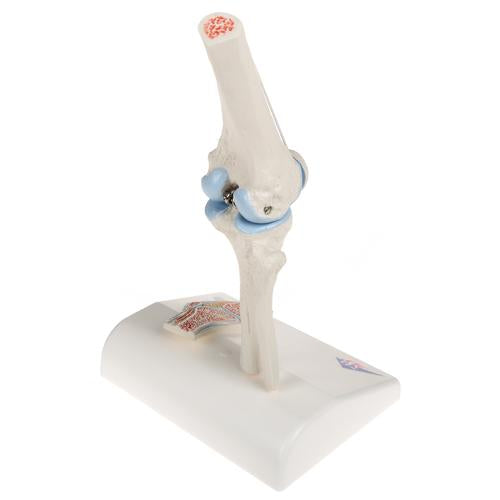 Mini-articulation du genou avec coupe transversale, sur socle - Anatomie et pathologie